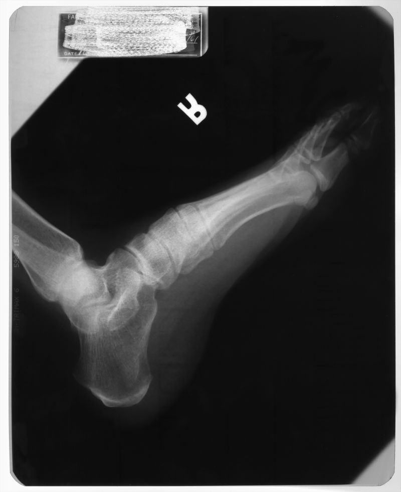 抽象骨骼手掌x射线片子