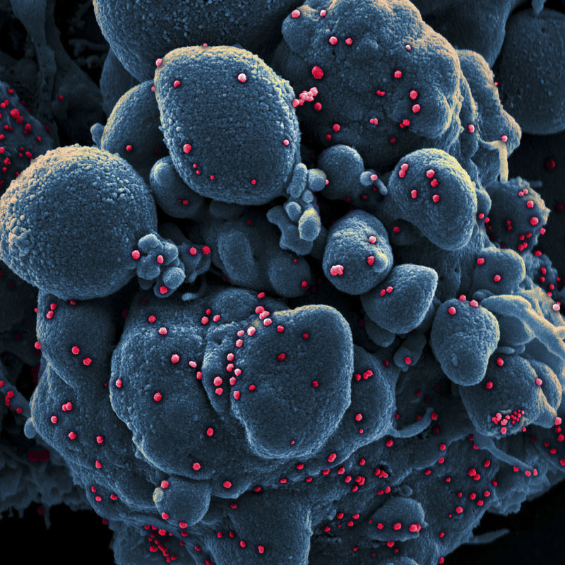 显微镜下粉红色背景上的冠状病毒