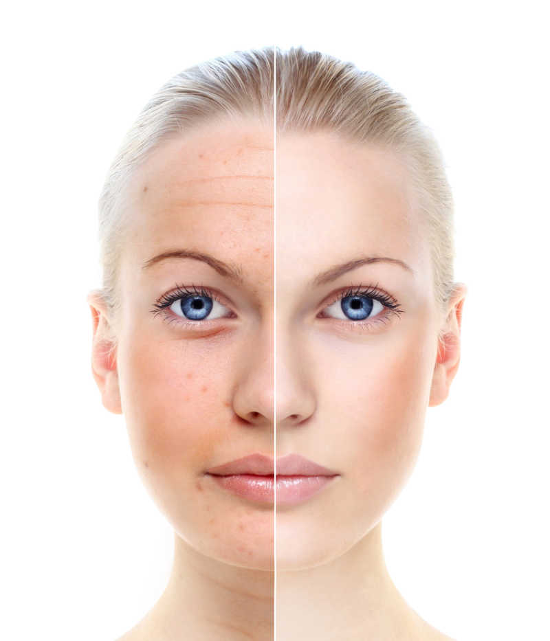 女人皮肤老化对比