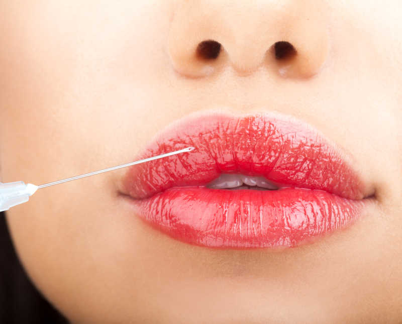 即将用注射器做嘴唇的美女