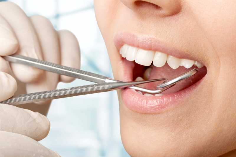 牙医给女人做牙齿检查