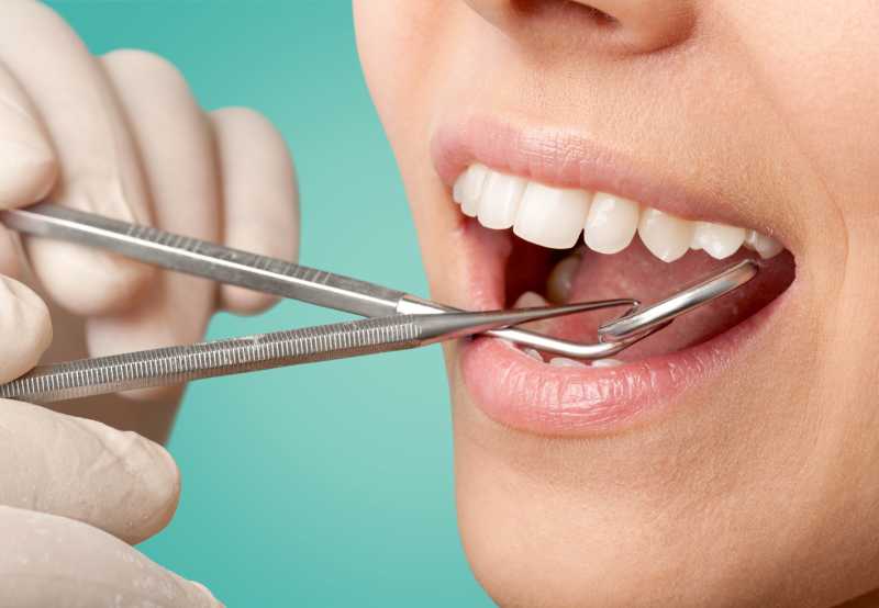 牙医在做牙齿检查