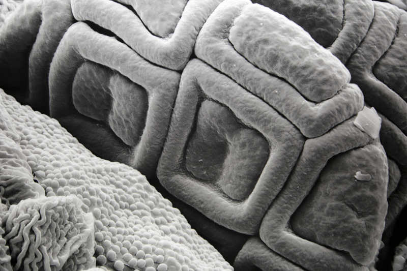 显微镜下的球菌