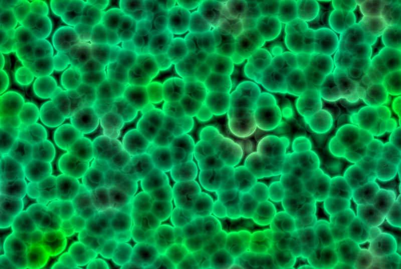 显微镜下的绿色球状细菌