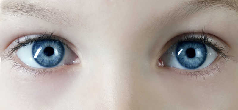儿童眼睛里有蓝斑图片图片