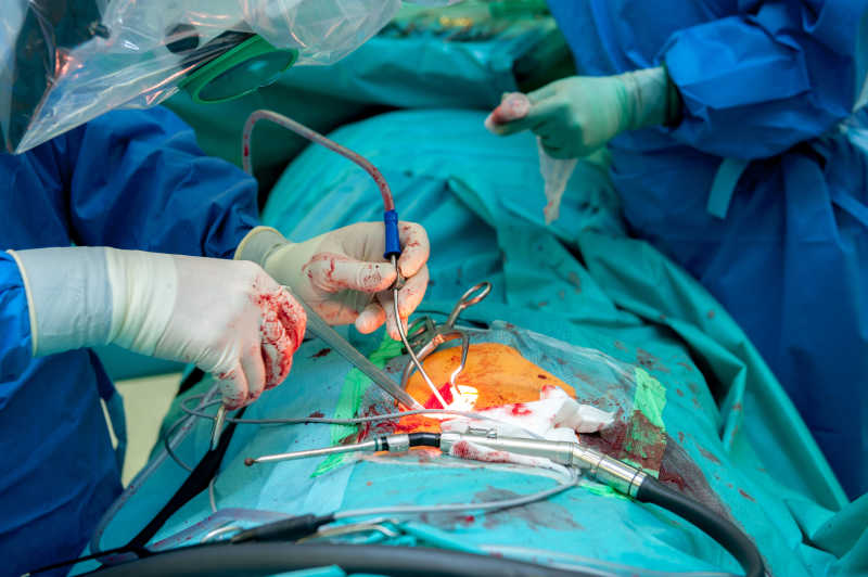 正在手术室给病人做手术的医生