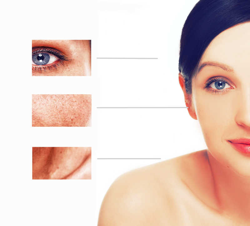 女子的皮肤老化问题