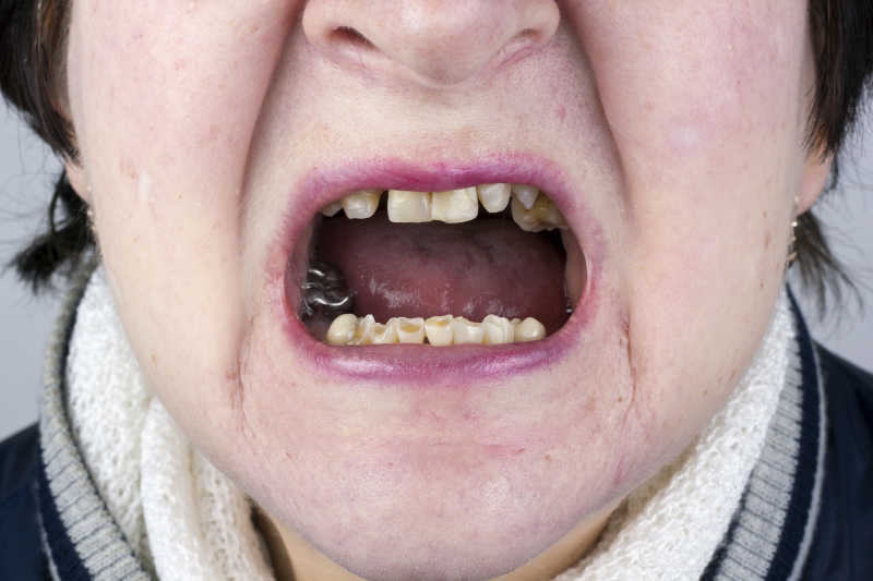 牙齿难看的女生图片图片