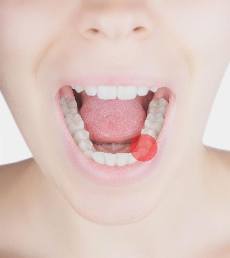 美女的口腔里的疼痛点