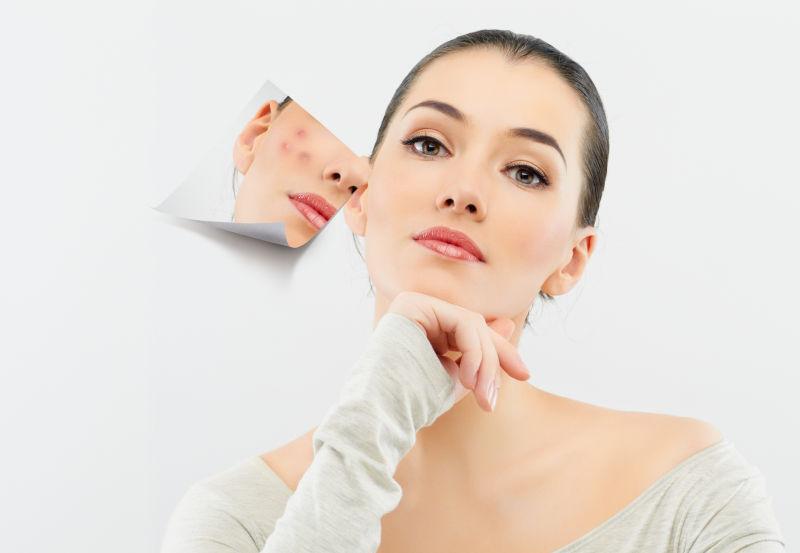 接受过微整的女人