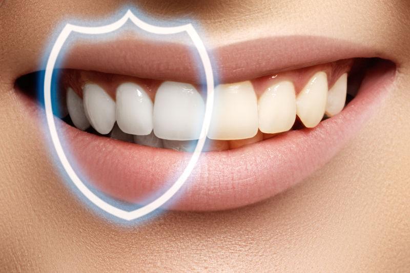 受保护的美女牙齿