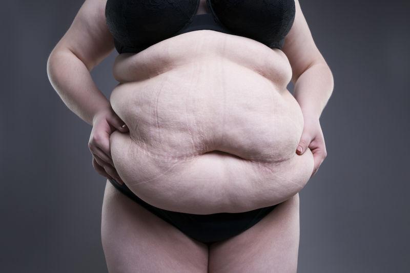 有着肥胖肚子的女人