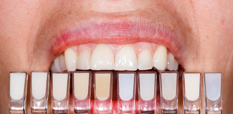 对比色度的牙齿