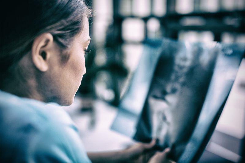 专心看X射线报告的女护士