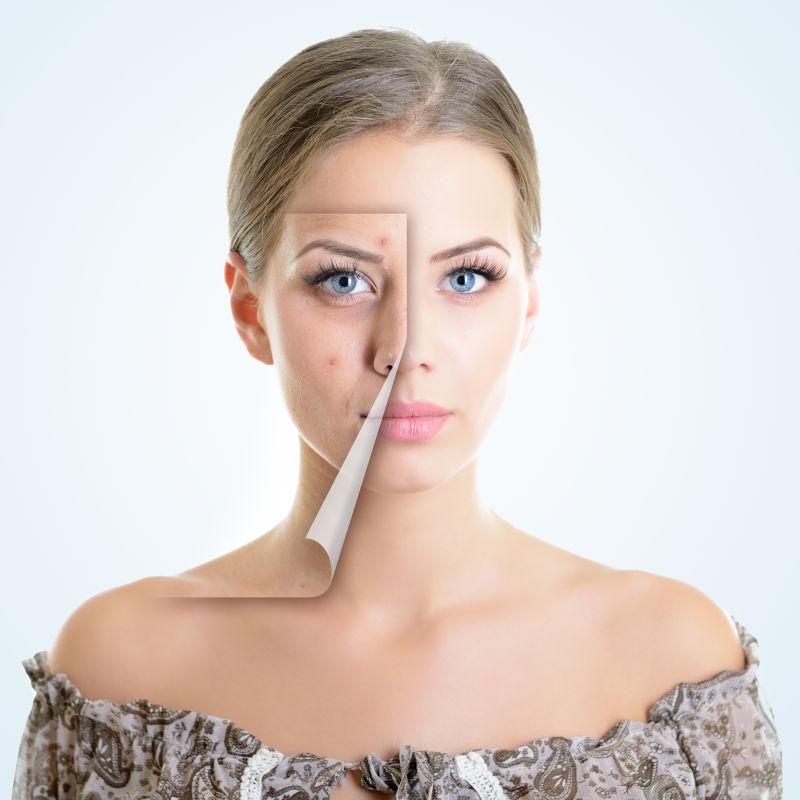 美丽女人的问题和干净皮肤