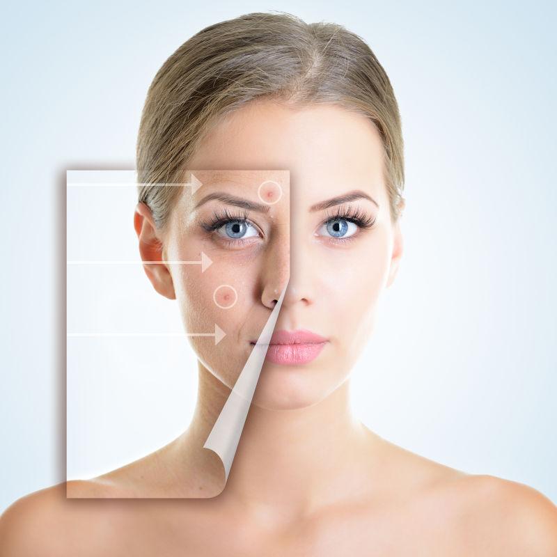 美丽女人的问题和干净的皮肤