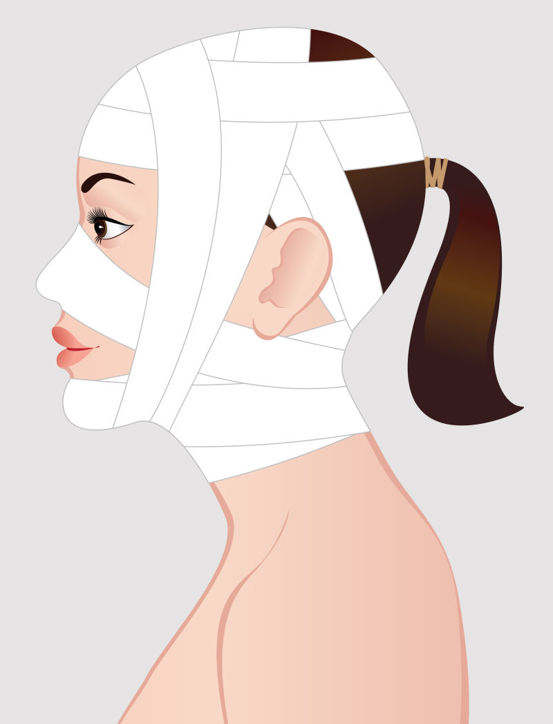美容手术后的年轻女性插图