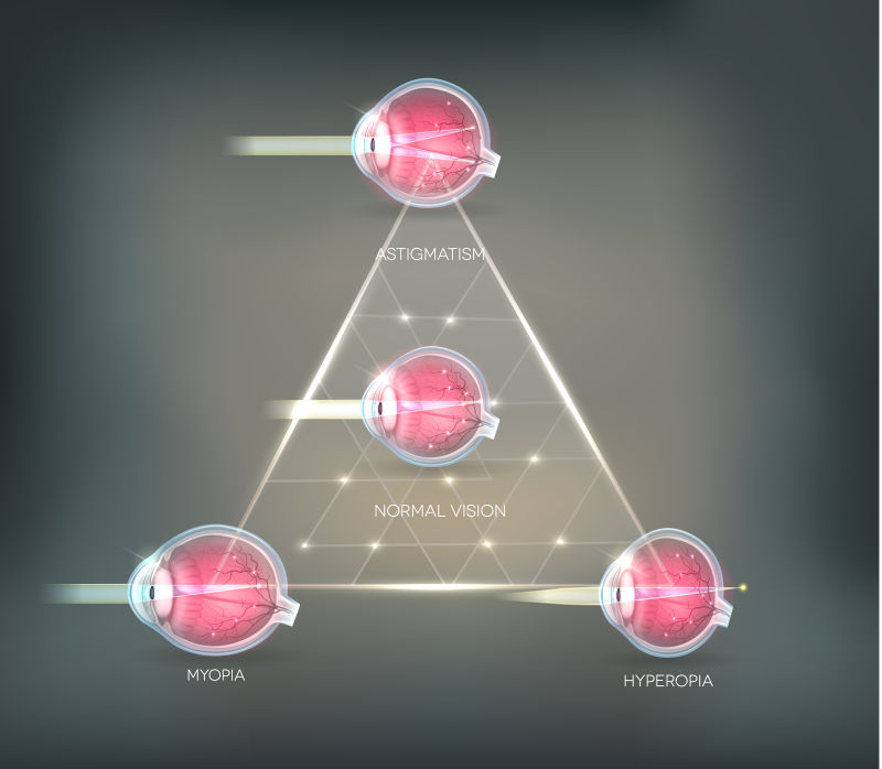 眼部疾病的矢量图