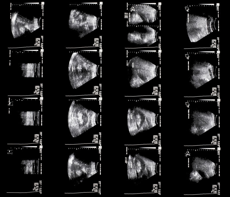 人体b超x射线片子