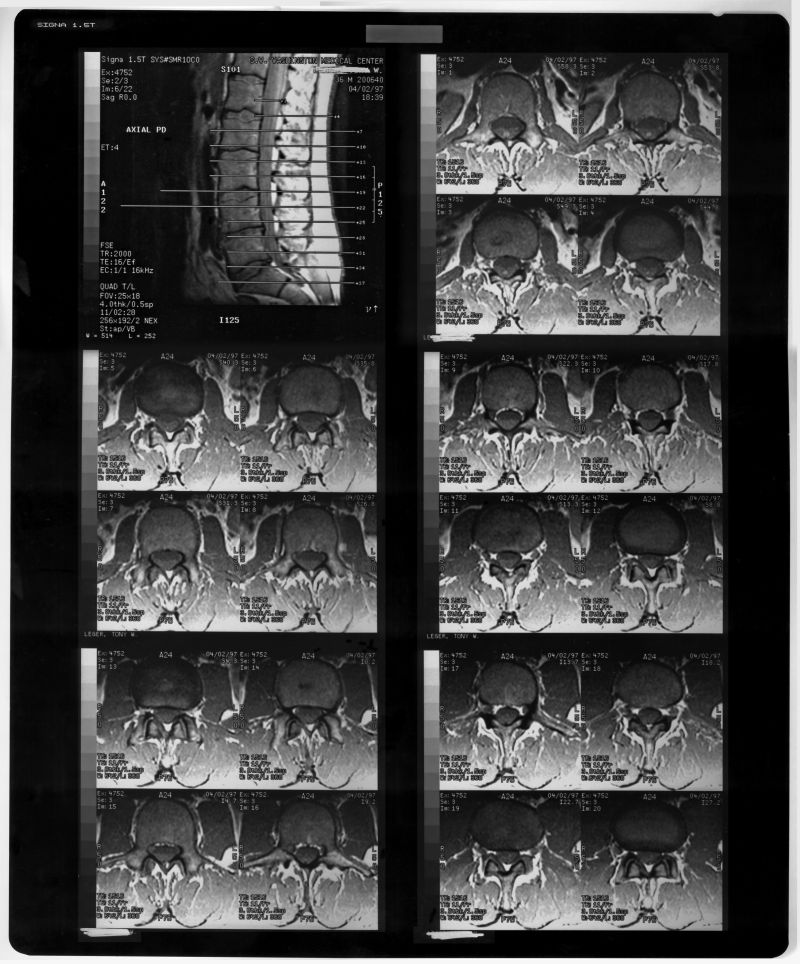 抽象的人体骨骼x射线片子