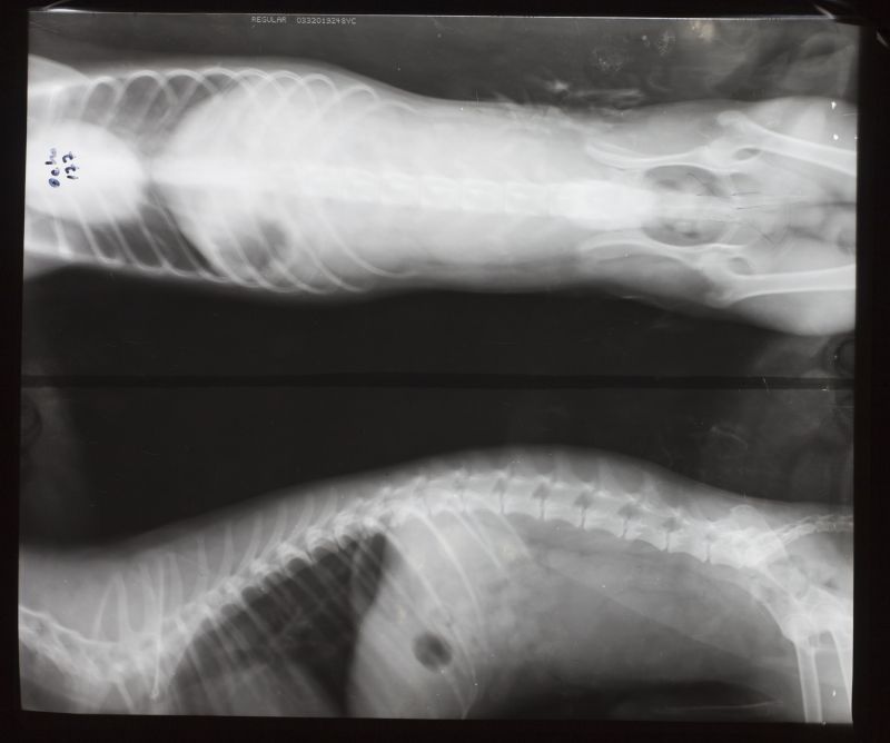 人体侧面骨骼x射线片子