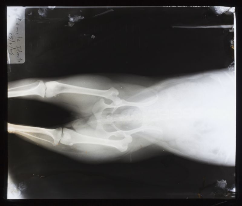 人体腹部x射线片子