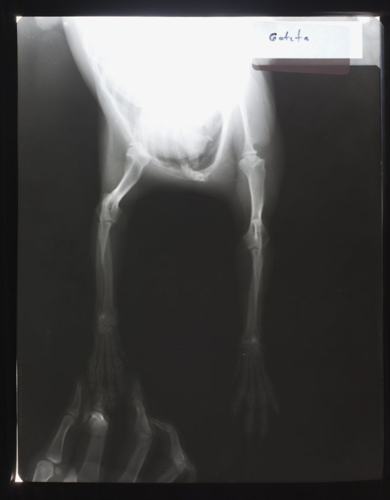 腿部骨骼x射线片子