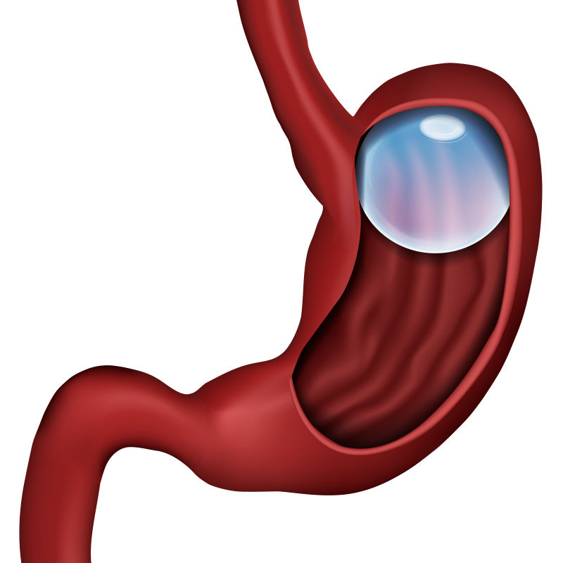 白底气球食道医学向量图