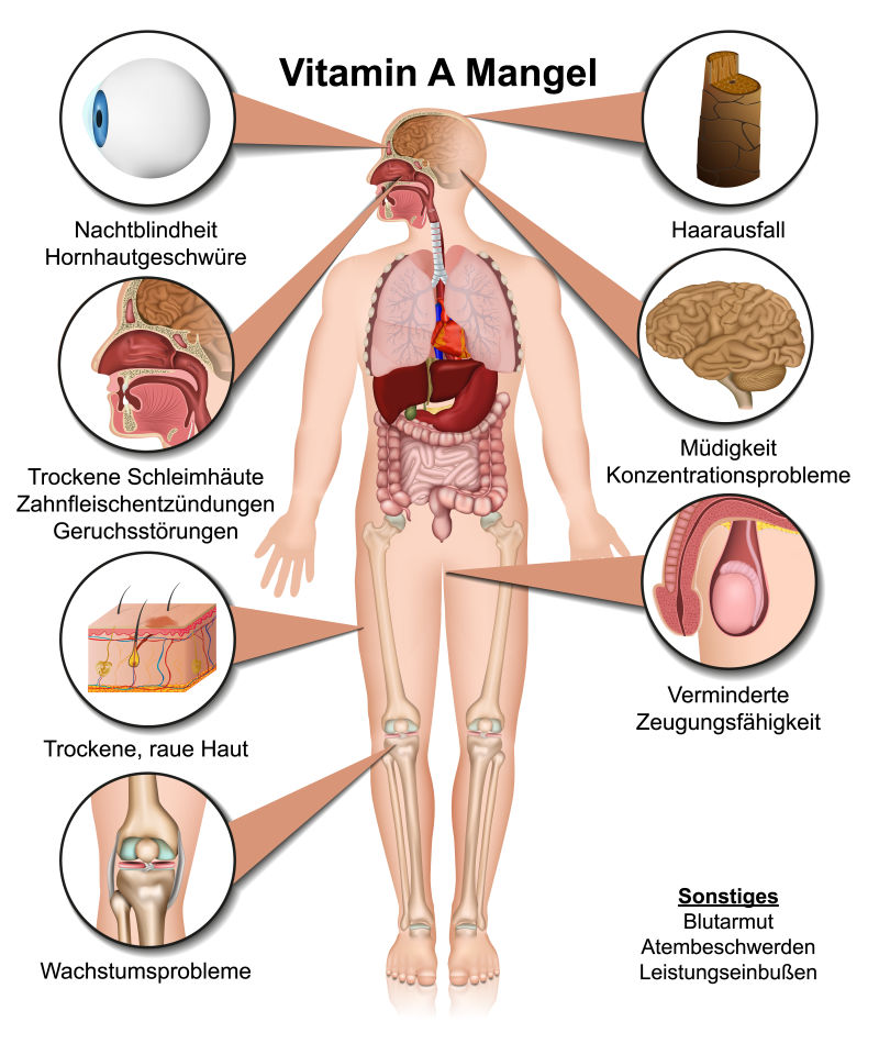 维生素A设备身体影响医学媒介白底插图