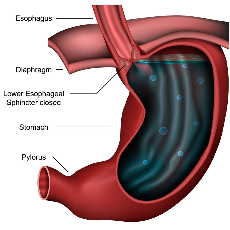 食管括约肌解剖回流三维医学矢量图