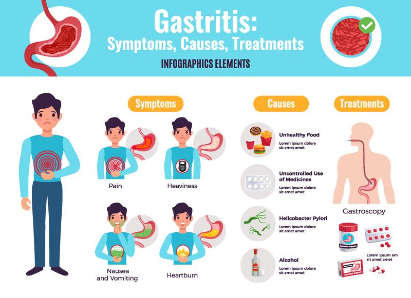 胃炎症状引起治疗综合信息海报与不健康食品实例胃镜检查程序医学平面向量图