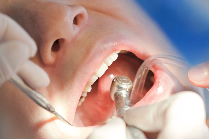牙科诊所镜检