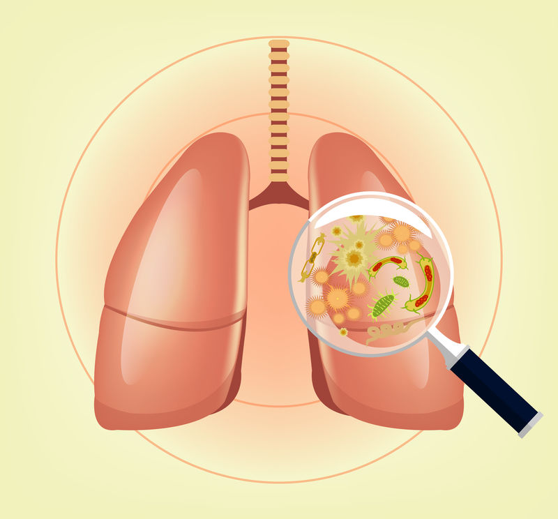 有细菌、细菌和放大镜的肺