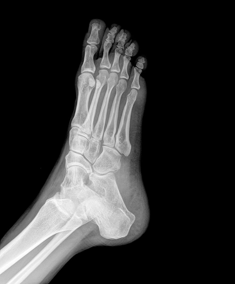 X射线下的身体骨骼