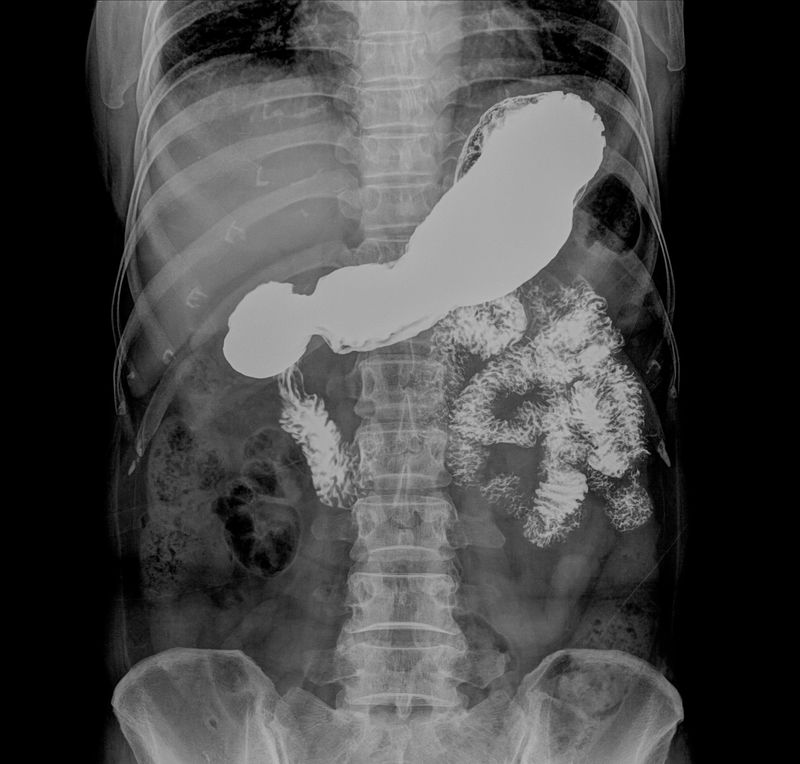 X射线下的身体骨骼