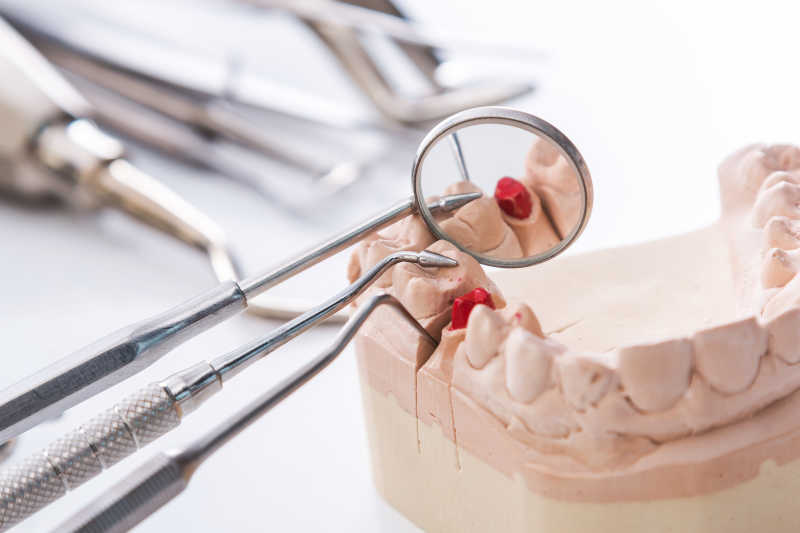 白色背景下的牙科工具检查假牙模型