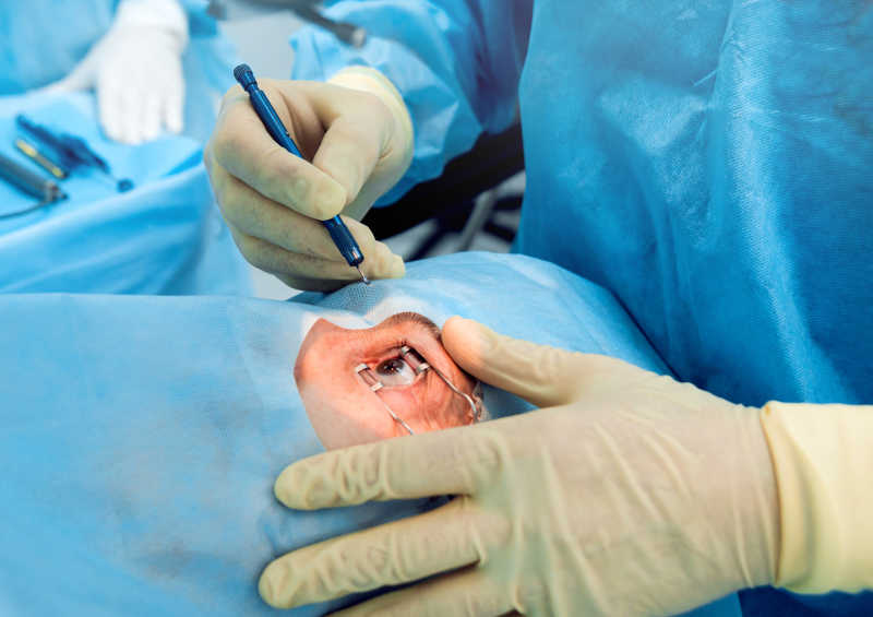 眼科手术消毒范围图片图片